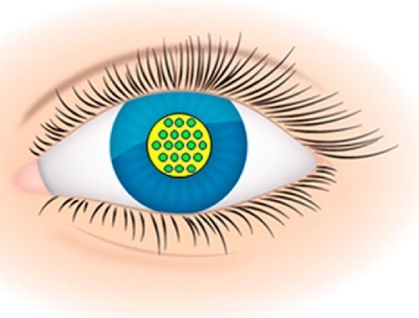Нанопластины заменят глазные капли
