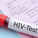 Новая вакцина от ВИЧ показала хорошие результаты в испытаниях на людях