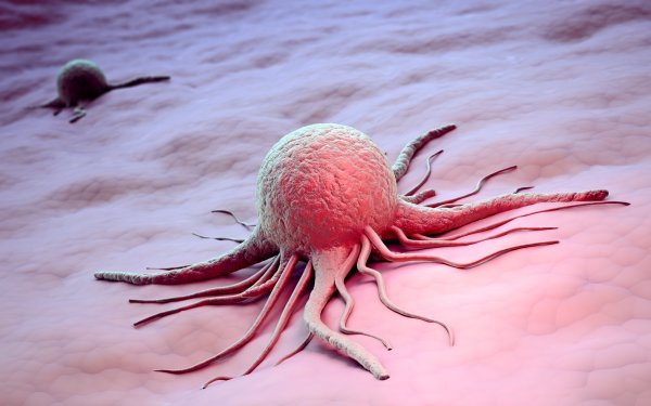 Ученые: Выявлена болезнь, которая повышает риск развития рака