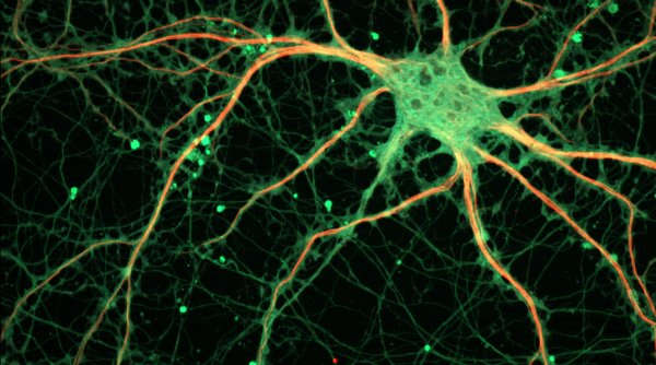 Учёные нашли поддерживающие сознание нейроны