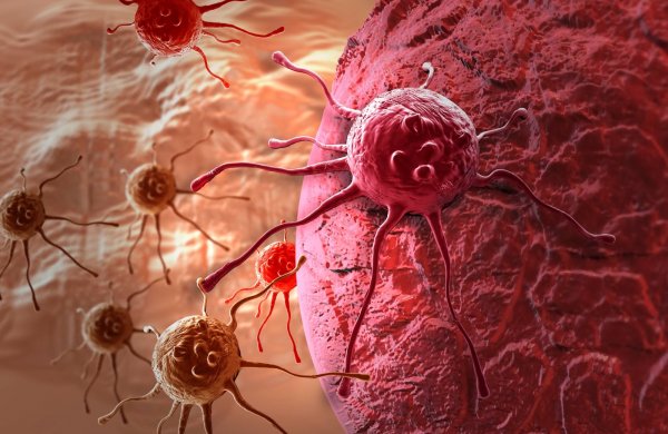 Рак молочной железы может стать причиной рака яичников – онкологи
