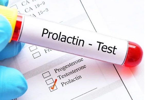 Сдать анализ на пролактин